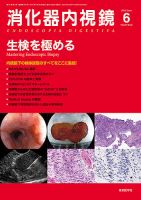 消化器内視鏡 15年6月号 (発売日2015年06月25日) 表紙