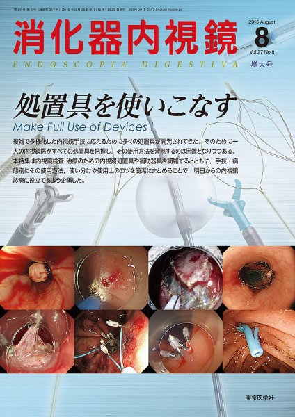 消化器内視鏡 15年8月増大号 (発売日2015年08月25日) | 雑誌/定期購読