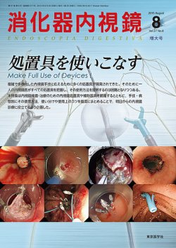 消化器内視鏡 15年8月増大号 (発売日2015年08月25日) | 雑誌