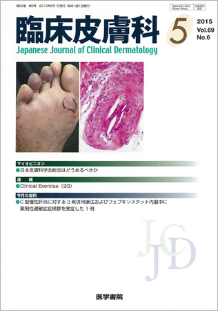 臨床皮膚科 Vol.69 No.6 (発売日2015年05月01日) | 雑誌/定期購読の