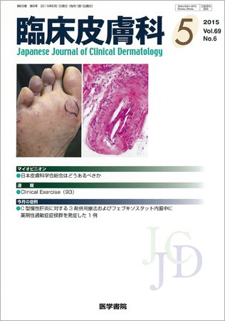 臨床皮膚科 Vol.69 No.6 (発売日2015年05月01日) 表紙