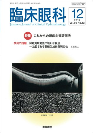 臨床眼科 Vol.69 No.13 (発売日2015年12月15日) 表紙