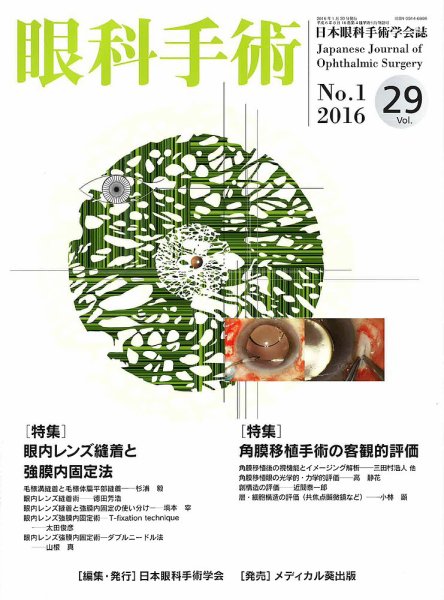眼科手術 Vol.29 No.1 (発売日2016年01月30日) 表紙