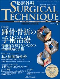 整形外科サージカルテクニック 2016年5号 (発売日2016年09月15日) 表紙