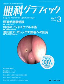 眼科グラフィック 2016年3号 (発売日2016年05月15日) 表紙