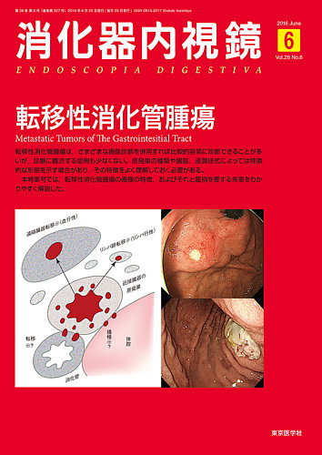 消化器内視鏡 16年6月号 (発売日2016年06月25日) | 雑誌/定期購読の