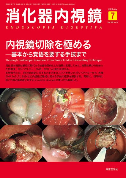 消化器内視鏡 16年7月号 (発売日2016年07月25日) 表紙