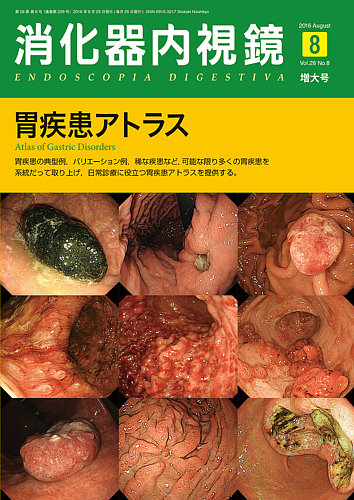 消化器内視鏡 16年8月増大号 (発売日2016年08月25日) | 雑誌