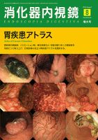 消化器内視鏡 16年8月増大号 (発売日2016年08月25日) 表紙