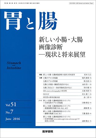 胃と腸 Vol.51 No.7 (発売日2016年06月25日) 表紙