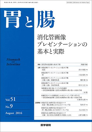 胃と腸 Vol.51 No.9 (発売日2016年08月25日) 表紙