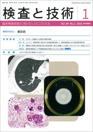 検査と技術 Vol.44 No.1 (発売日2016年01月01日) 表紙