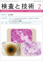 検査と技術 Vol.44 No.2 表紙