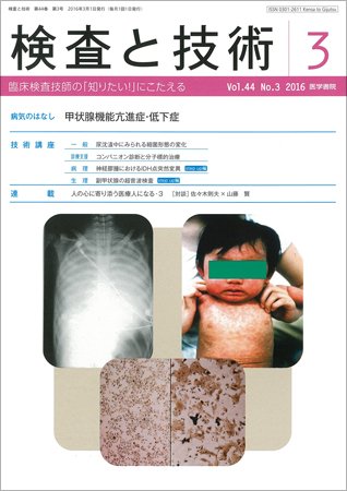 検査と技術 Vol.44 No.3 (発売日2016年03月01日) 表紙