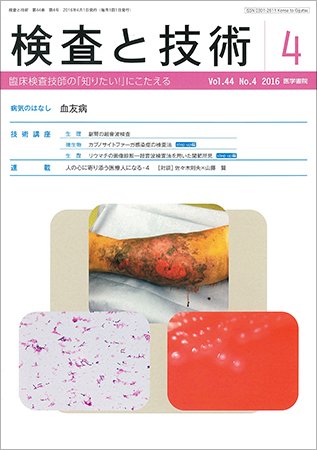 検査と技術 Vol.44 No.4 (発売日2016年04月01日) 表紙