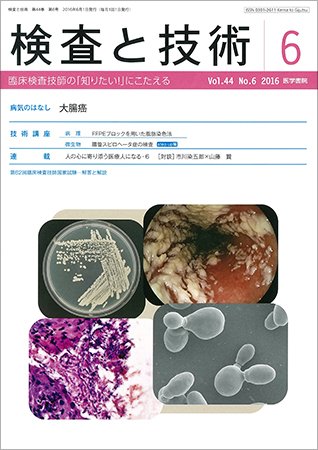 検査と技術 Vol.44 No.6 (発売日2016年06月01日) 表紙
