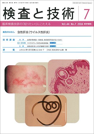 検査と技術 Vol.44 No.7 (発売日2016年07月01日) 表紙