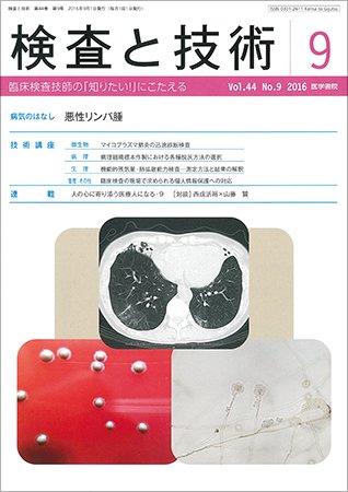検査と技術 Vol.44 No.9 (発売日2016年09月01日) 表紙