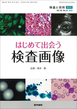 検査と技術 Vol.44 No.10 (発売日2016年09月15日) 表紙