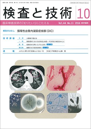 検査と技術 Vol.44 No.11 (発売日2016年10月01日) 表紙