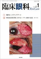 臨床眼科 Vol.70 No.1 (発売日2016年01月15日) 表紙
