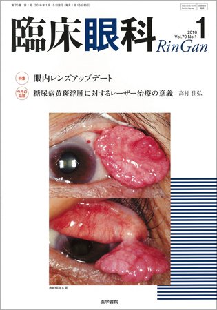 臨床眼科 Vol.70 No.1 (発売日2016年01月15日) 表紙