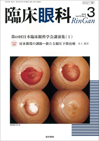 臨床眼科 Vol.70 No.3 (発売日2016年03月15日) 表紙