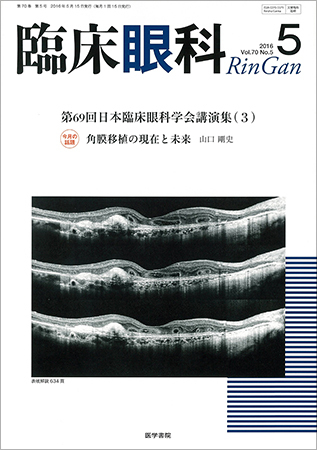 臨床眼科 Vol.70 No.5 (発売日2016年05月15日) | 雑誌/定期購読の予約