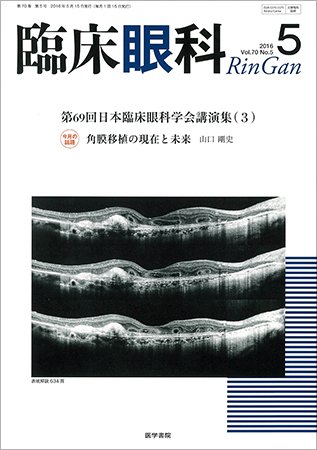 臨床眼科 Vol.70 No.5 (発売日2016年05月15日) 表紙