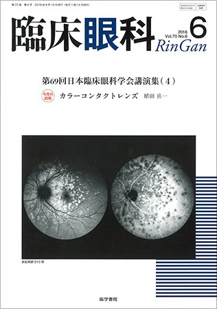 臨床眼科 Vol.70 No.6 (発売日2016年06月15日) 表紙