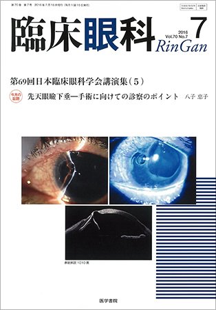 臨床眼科 Vol.70 No.7 (発売日2016年07月15日) 表紙