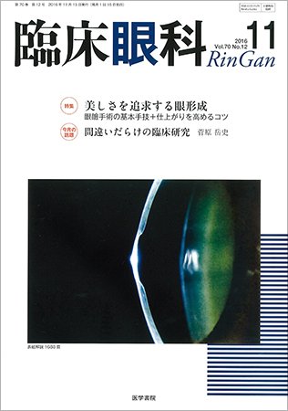 臨床眼科 Vol.70 No.12 (発売日2016年11月15日) 表紙