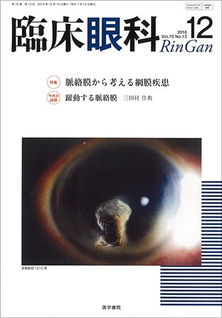 臨床眼科 Vol.70 No.13 (発売日2016年12月15日) 表紙