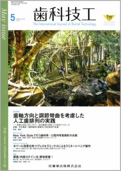 歯科技工 Vol.44 No.5 (発売日2016年04月30日) 表紙