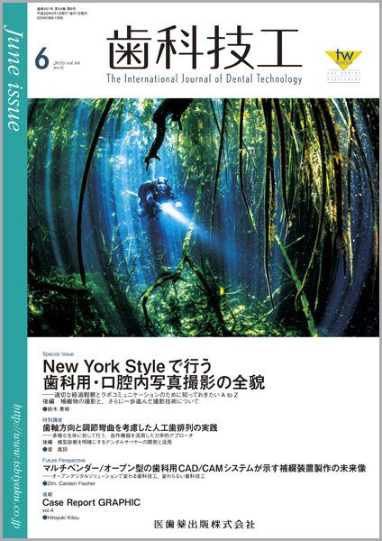 歯科技工 Vol.44 No.6 (発売日2016年05月31日) 表紙