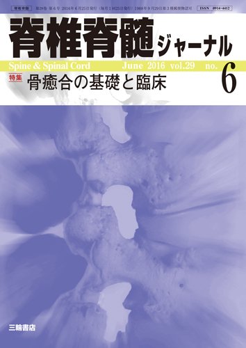 脊椎脊髄ジャーナル 29巻6号 (発売日2016年05月25日) 表紙