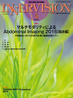 INNERVISION（インナービジョン） 2016年5月号 (発売日2016年05月01日) 表紙