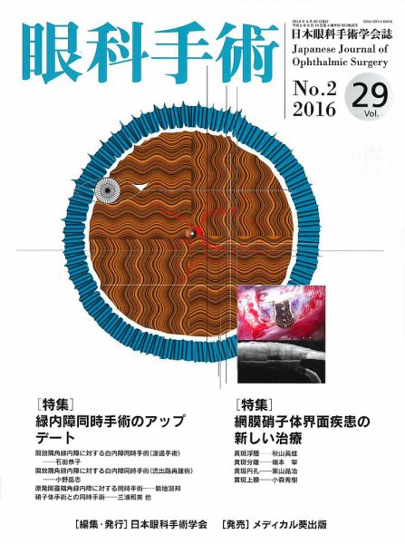 眼科手術 Vol.29 No.2 (発売日2016年04月30日) 表紙