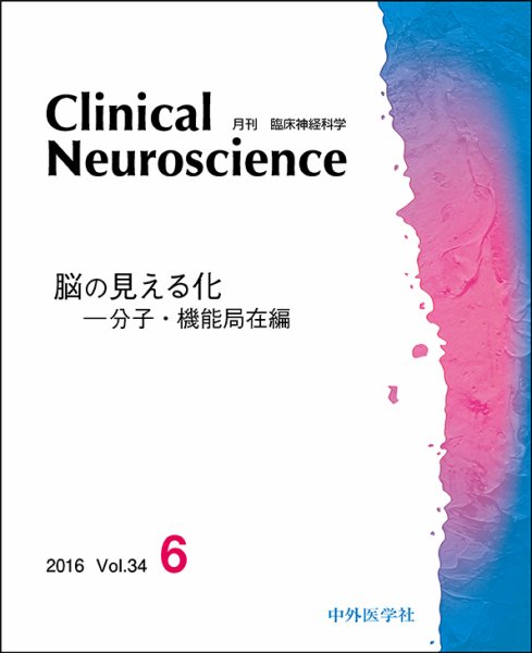 Clinical Neuroscience（クリニカルニューロサイエンス） 2016年6月号 (発売日2016年06月01日) 表紙
