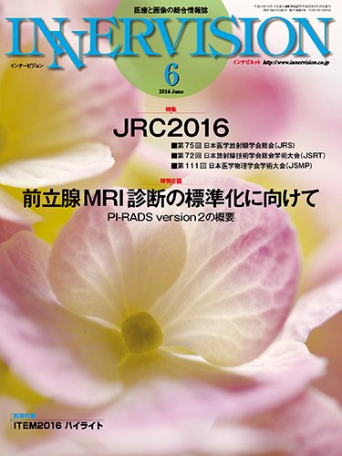 INNERVISION（インナービジョン） 2016年6月号 (発売日2016年06月01日) 表紙