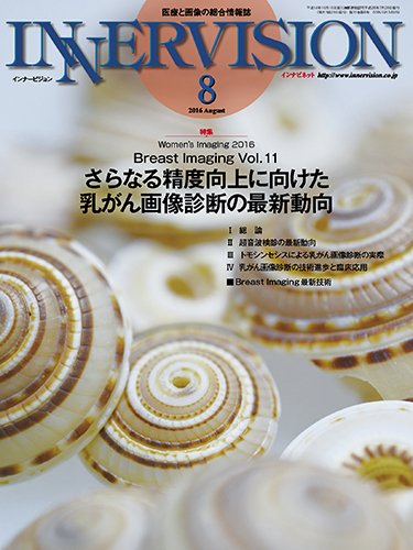 INNERVISION（インナービジョン） 2016年8月号 (発売日2016年08月01日) 表紙