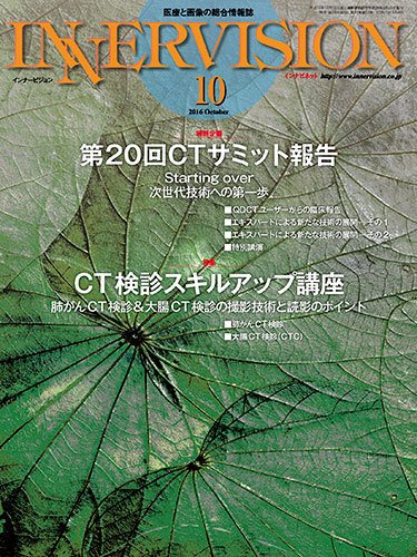 INNERVISION（インナービジョン） 2016年10月号 (発売日2016年10月01日) 表紙