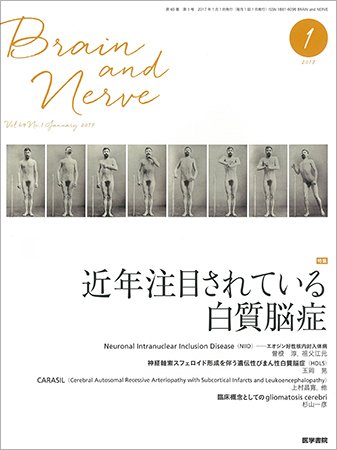 BRAIN and NERVE（ブレインアンドナーブ） Vol.69 No.1 (発売日2017年01月01日) 表紙