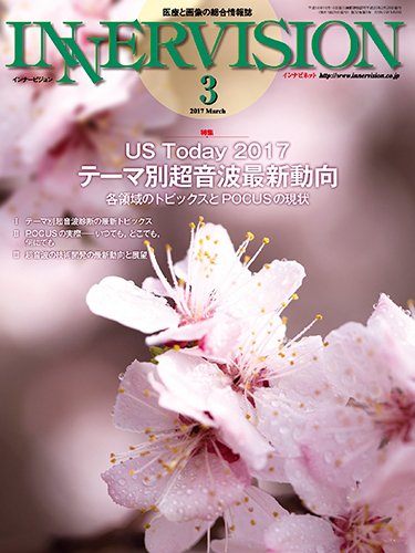 INNERVISION（インナービジョン） 2017年3月号 (発売日2017年03月01日) 表紙
