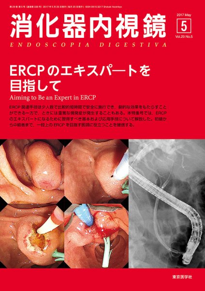 消化器内視鏡 17年5月号 (発売日2017年05月25日) 表紙
