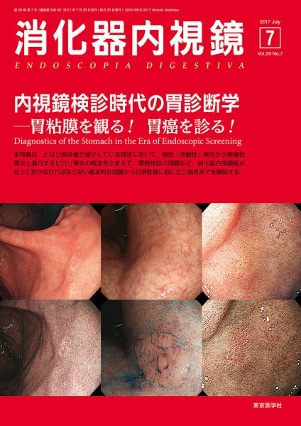 消化器内視鏡 17年7月号 (発売日2017年07月25日) 表紙