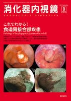 消化器内視鏡 17年9月号 (発売日2017年09月25日) 表紙