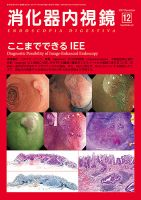 消化器内視鏡 17年12月号 (発売日2017年12月25日) 表紙
