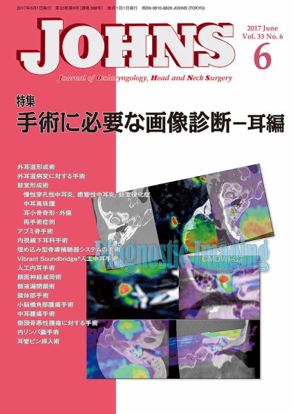 JOHNS（ジョウンズ） 17年6月号 (発売日2017年06月01日) 表紙