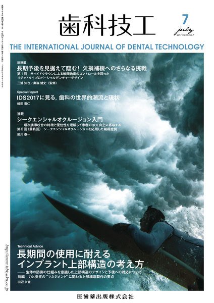 歯科技工 Vol.45 No.7 (発売日2017年06月30日) 表紙